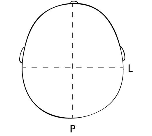 MESURE D’UNE BRACHYCÉPHALIE